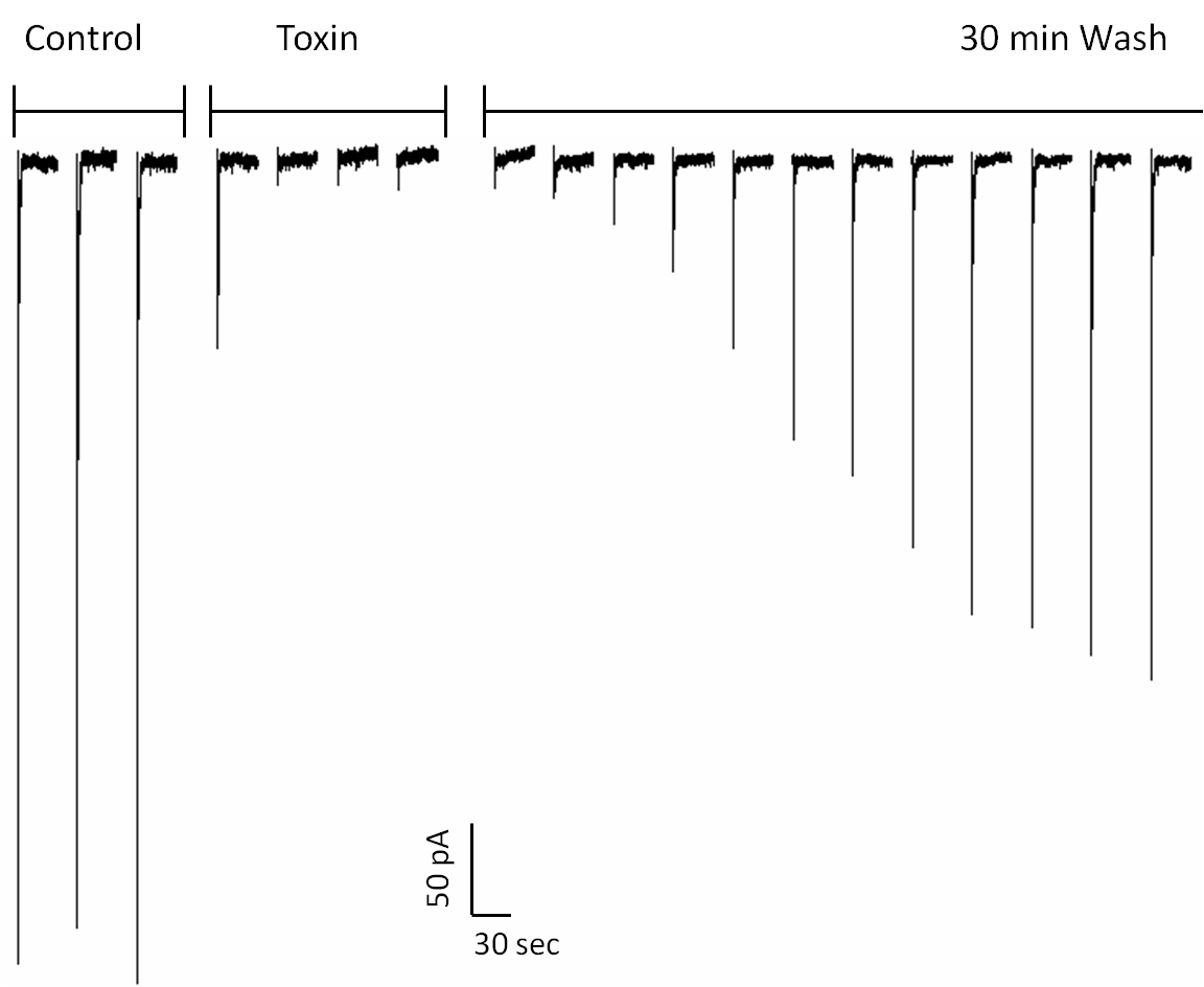 Electrical recording